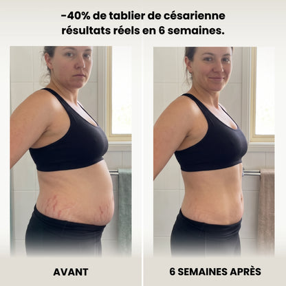 AneaLift™ – Culotte gainante post-partum 360°